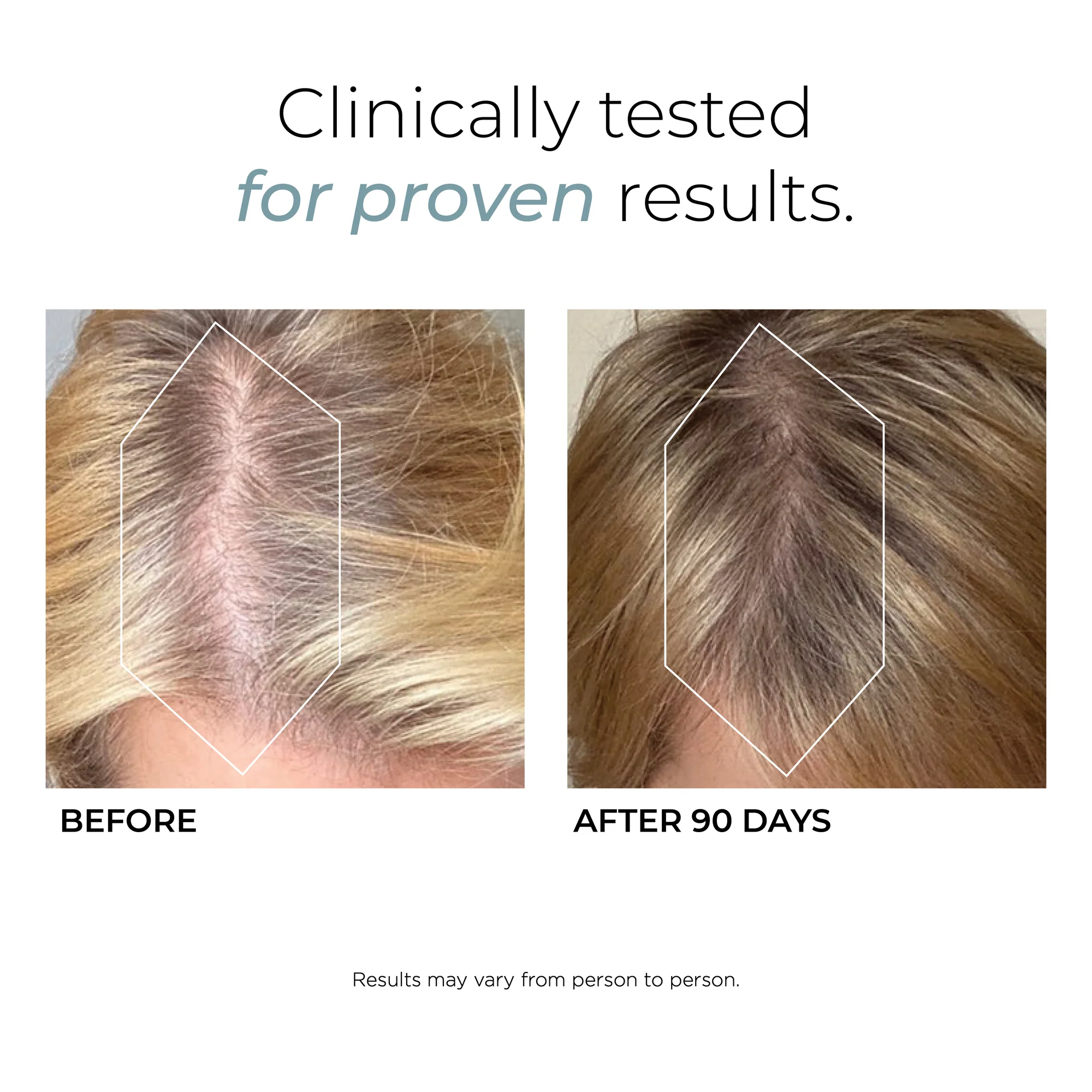 Hush & Hush DeeplyRooted 120 Capsules 0 กก.