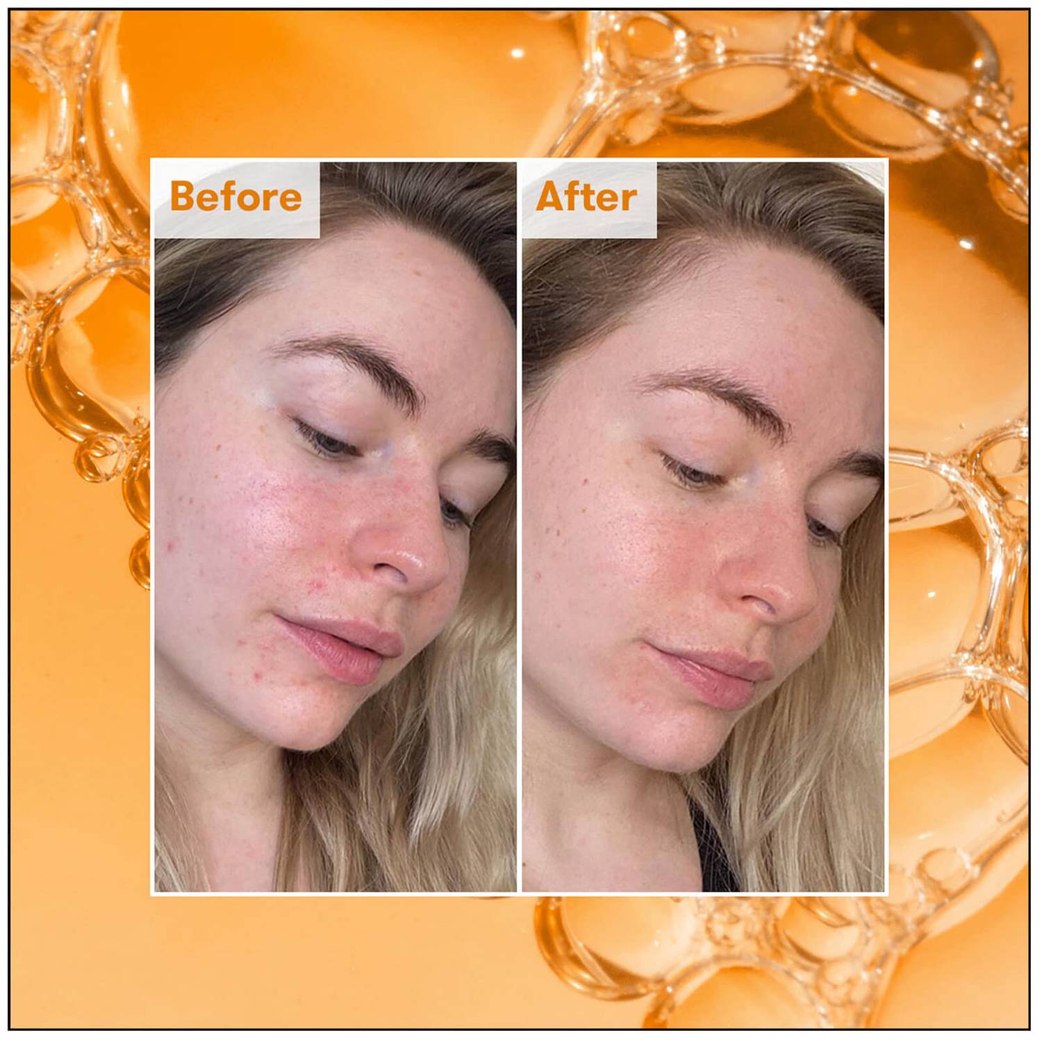 REN CLEAN SKINCARE READY STEADY GLOW DAILY AHA TONIC 250ML 0 กก.