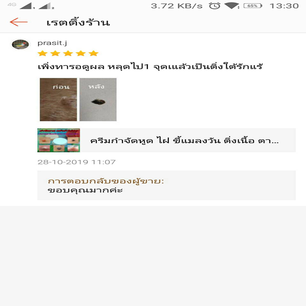 Clear Up ครีม กำจัด ไฝ หูด ตาปลา ติ่งเนื้อ ขี้แมลงวัน สูตรธรรมชาติ 100%