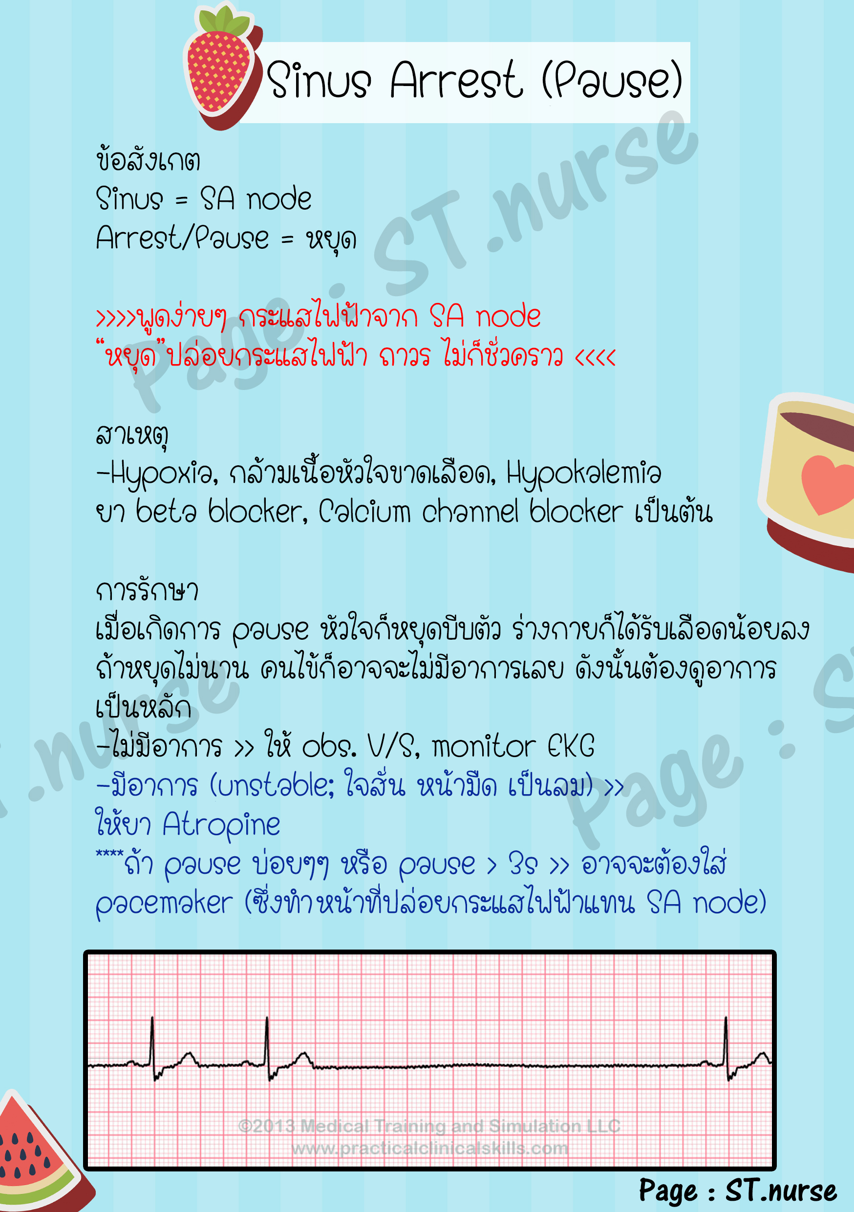 สมุดสอนอ่าน EKG ง่ายๆ (St.nurse Easy ECG)