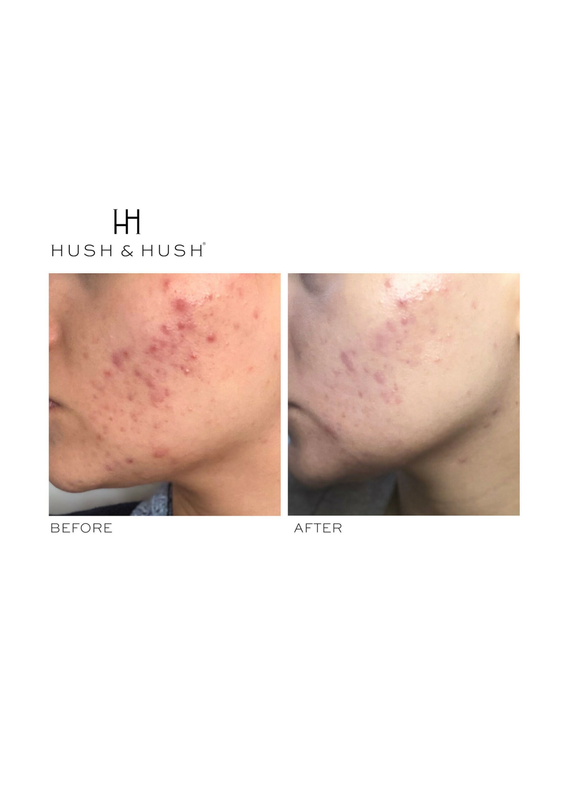 Hush&Hush SkinCapsule™ CLEAR+ 60 Capsules 0 กก.