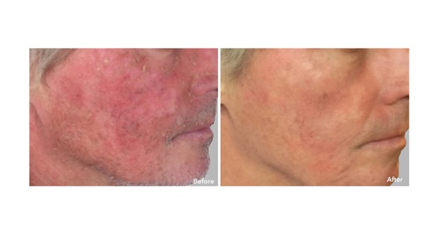 AnteAGE MD Serum (30ml) 0 กก.