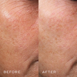 Medik8 Crystal Retinol 3, 30ml 0 กก.