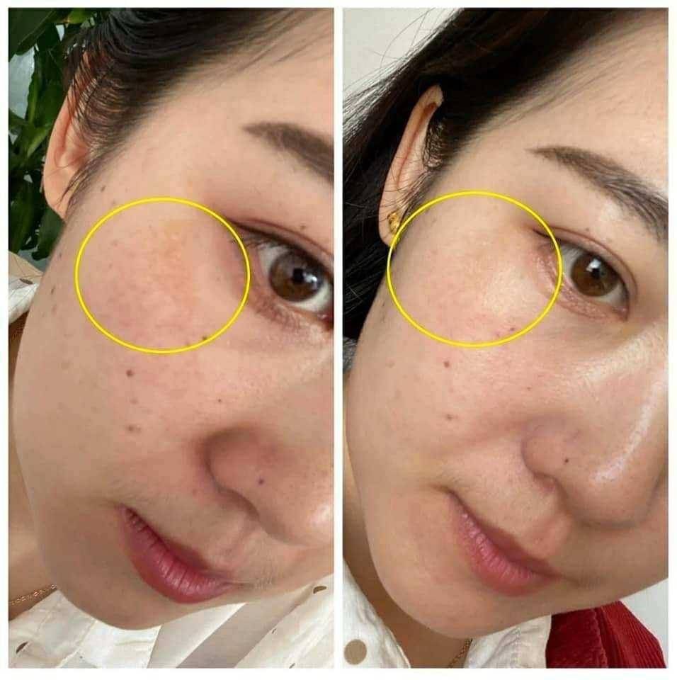 Clinique Even Better Clinical Radical Dark Spot Corrector + Interrupter