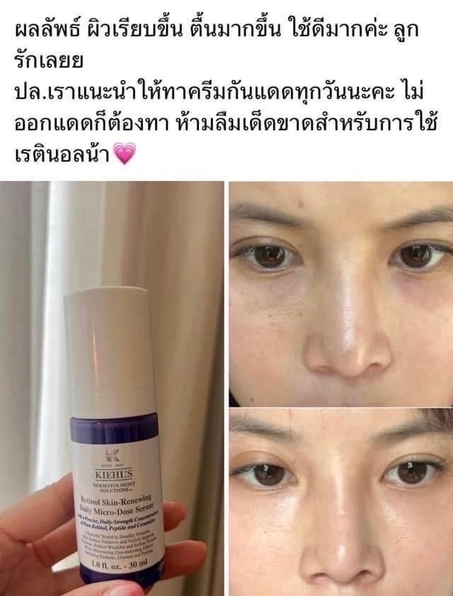 Kiehl’s Retinol Skin-Renewing Daily Micro-Dose Serum