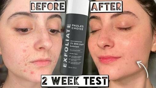 Paula's Choice Skin Perfecting 2% BHA Liquid Exfoliant 10 ml