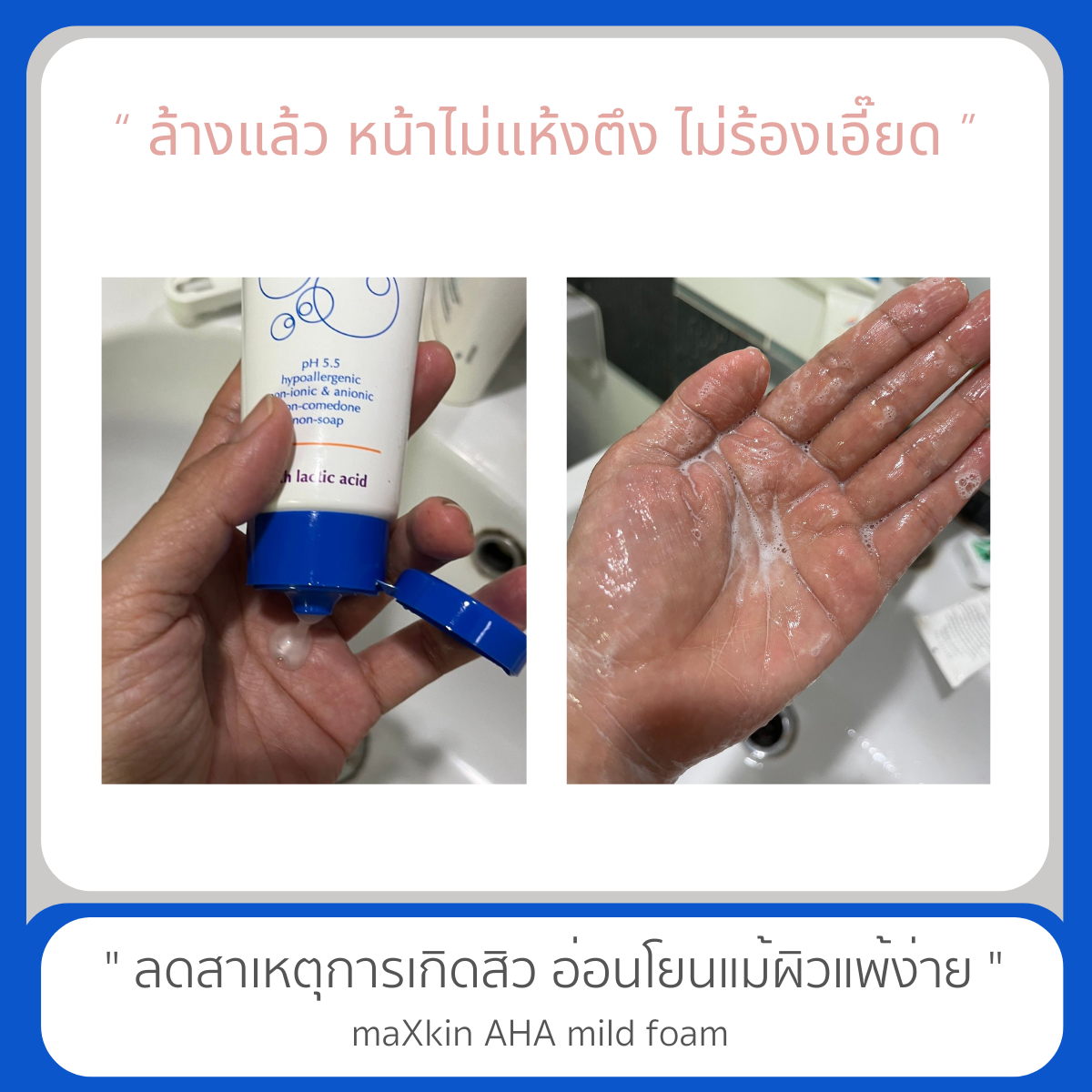 maXkin AHA Mild Foam (แม็กสกิน เอ เอช เอ มายด์โฟม)