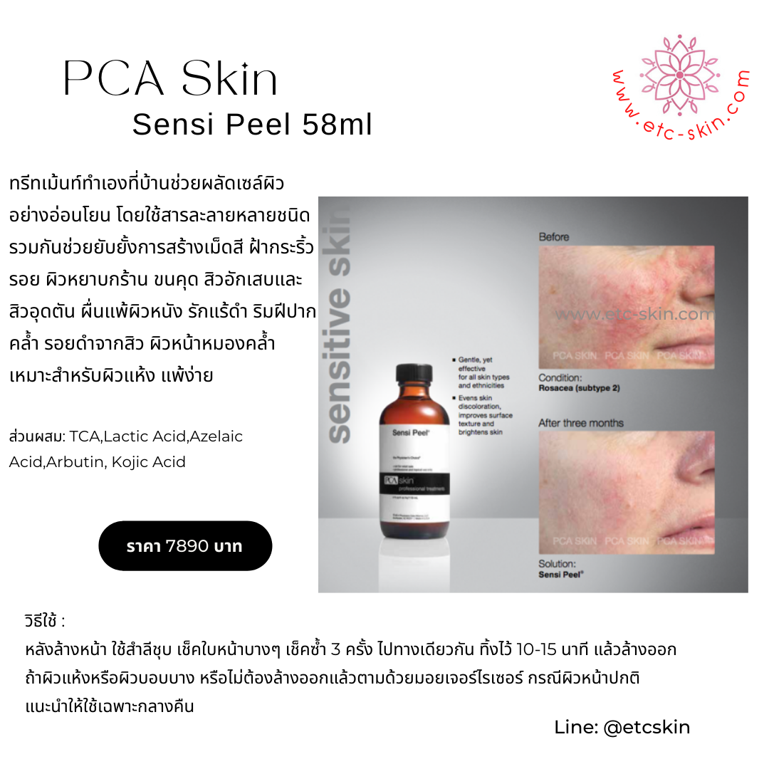 PCA Skin PCA Skin Sensi Peel 1.96oz/58ml 58 กรัม