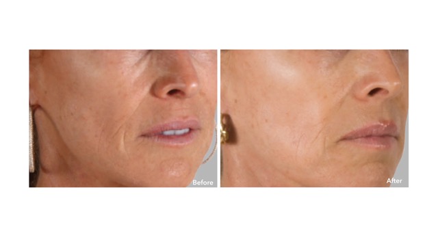 AnteAGE MD Serum (30ml) 0 กก.