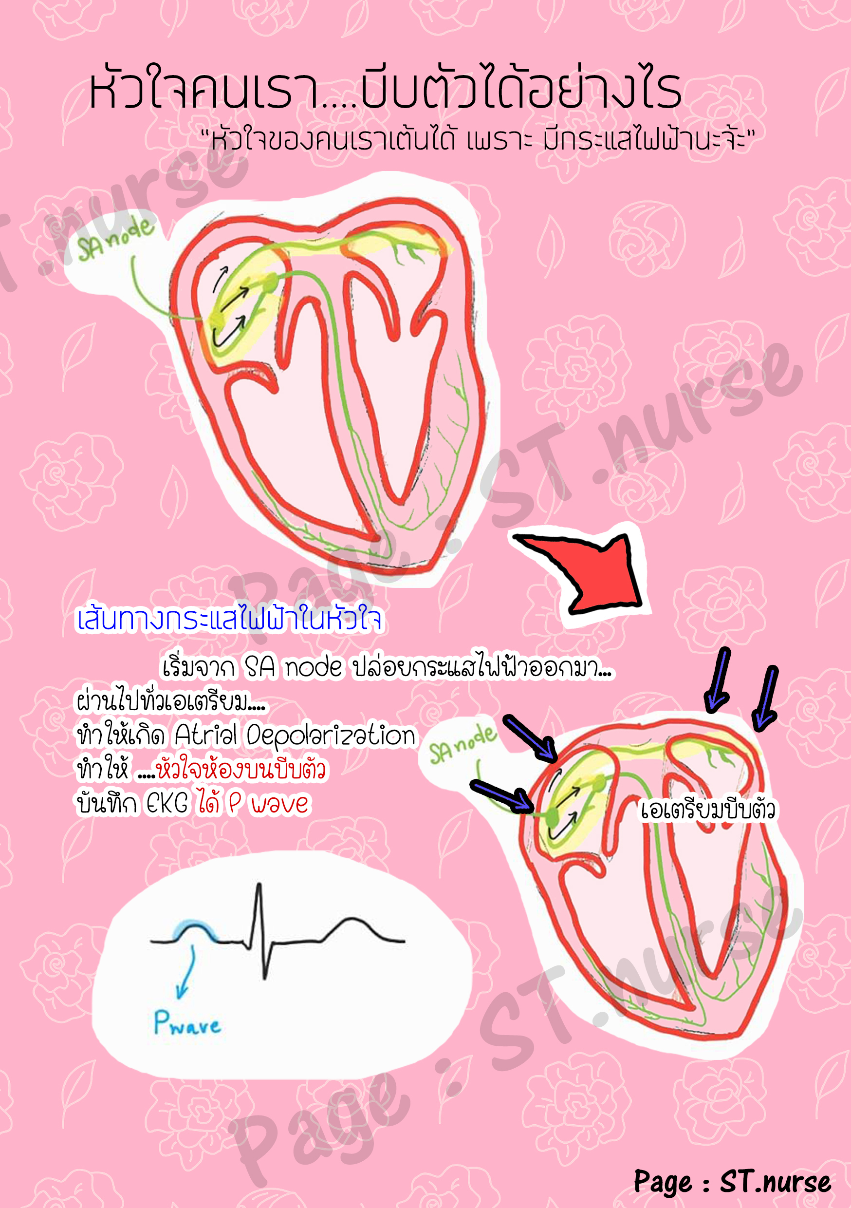 สมุดสอนอ่าน EKG ง่ายๆ (St.nurse Easy ECG)