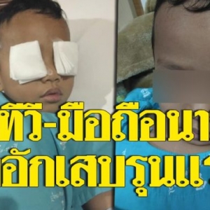 เตือนภัยใกล้ตัว ปล่อยลูกดูทีวี-มือถือ นานเกิน สุดท้ายป่วยหนัก ตาอักเสบรุนแรง