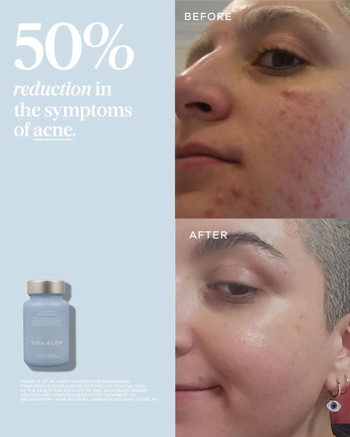 Vida Glow Clear Advanced Repair 30 Capsules 0 กรัม