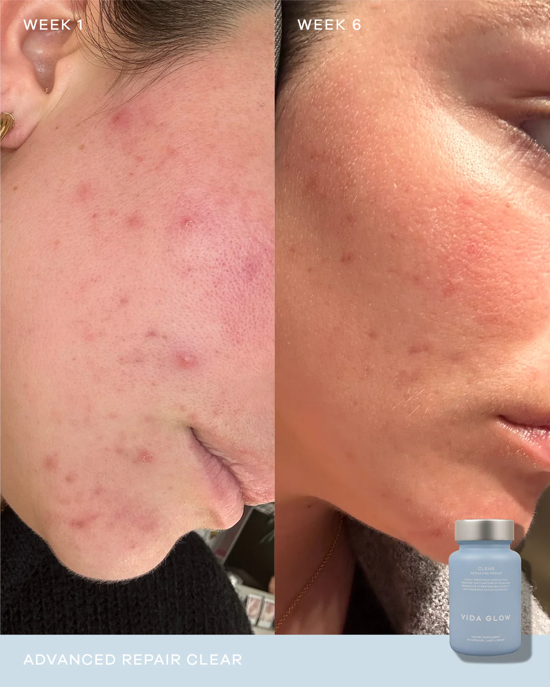 Vida Glow Clear Advanced Repair 30 Capsules 0 กรัม