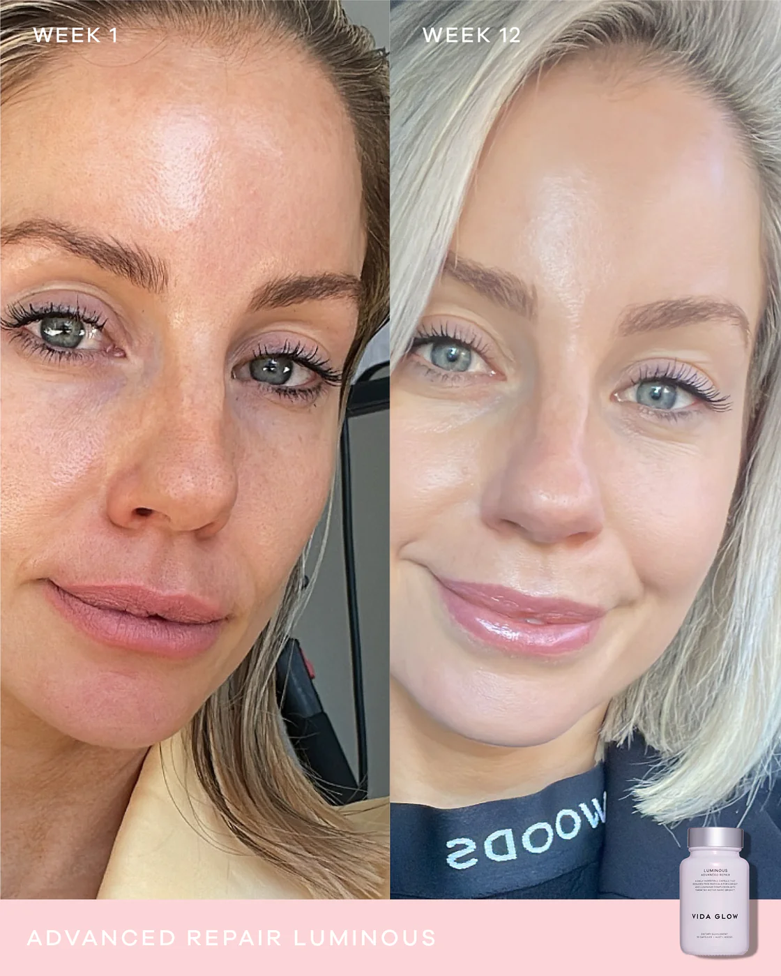 Vida Glow Advanced Repair Luminous Capsules 30 Capsules 0 กรัม